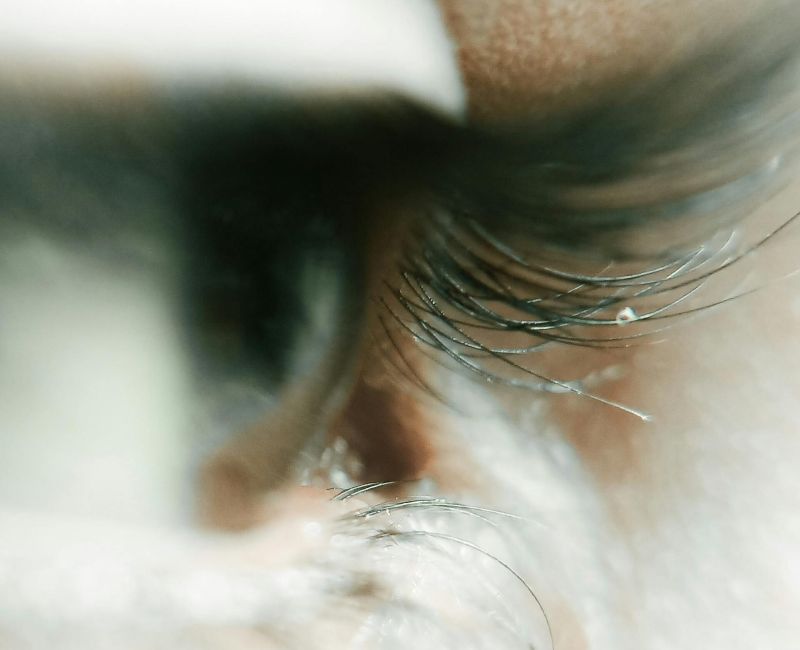 glaucoma istituto ottico veronesi bologna