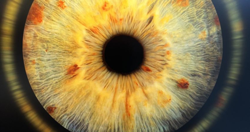 come e fatto l'occhio istituto ottico veronesi bologna