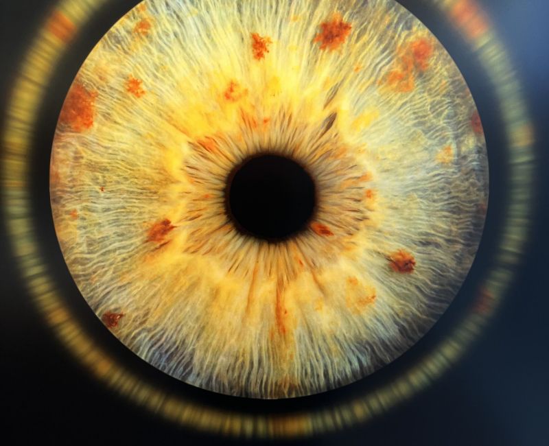 come e fatto l'occhio istituto ottico veronesi bologna