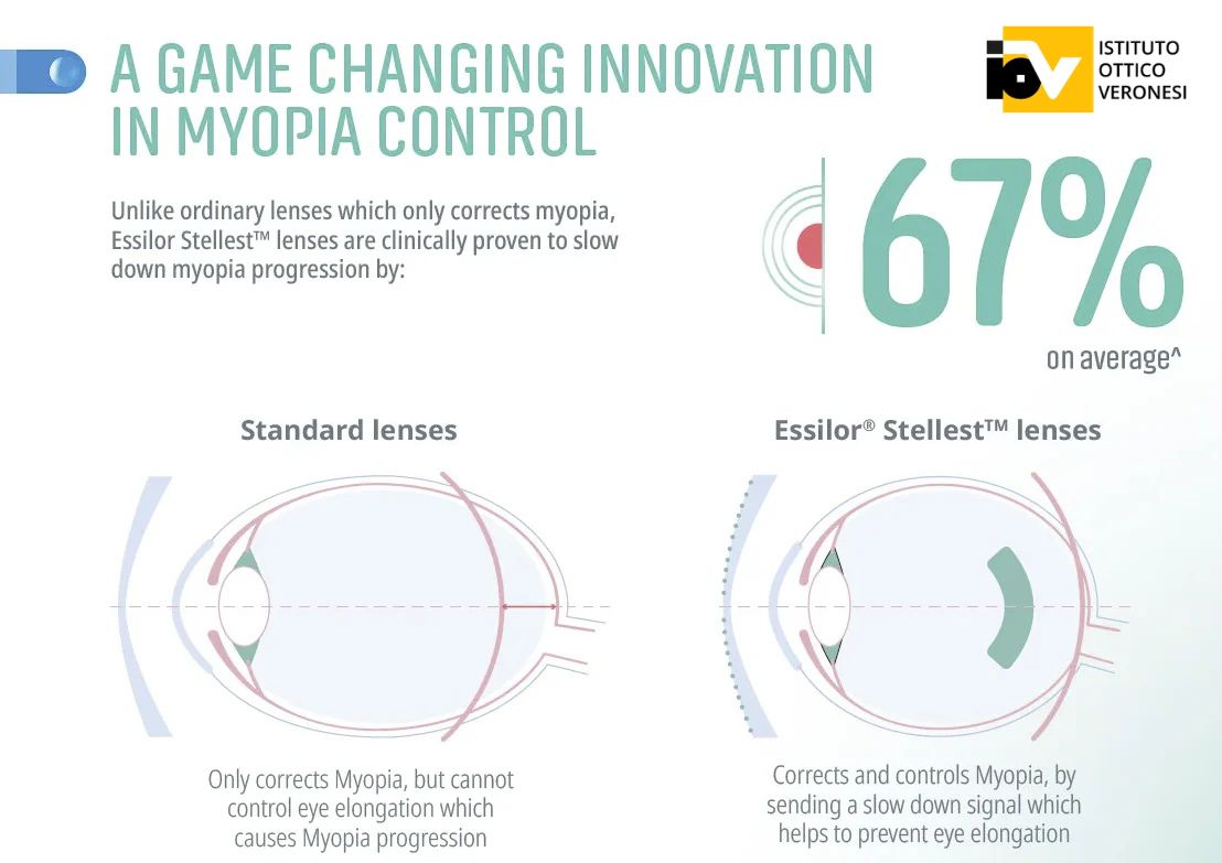 come curare la miopia nei bambini istituto ottico veronesi bologna